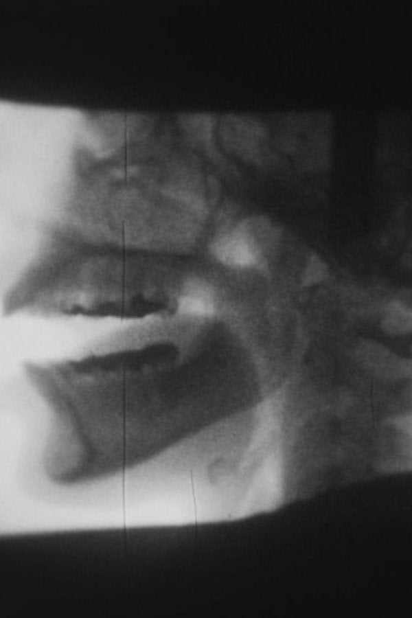 X-Ray (1982) - Premium Movie Poster